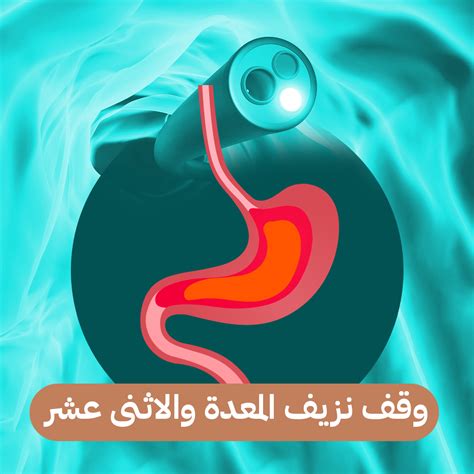 طريقة عمل الأوركيد لعلاج نزيف المعدة والأمعاء والدوسنتاريا والبواسير