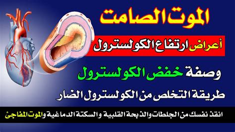 علاج ارتفاع نسبة الكولسترول في الدم مع الشمندر علاج ارتفاع نسبة الكولسترول في الدم مع الشمندر