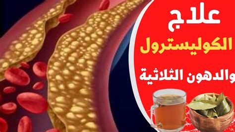 علاج ارتفاع نسبة الكوليسترول في الجسم