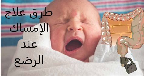 علاج الإمساك عند الرضع في عمر الشهرين بشكل طبيعي