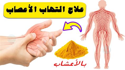 علاج التهاب الأعصاب المحيطية بالأعشاب الطبيعية