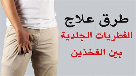 علاج الدموع بين الفخذين