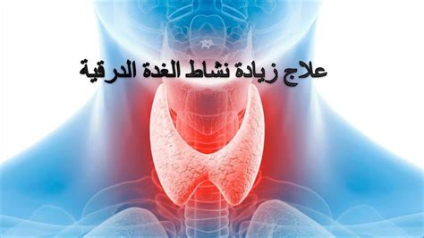 علاج مرض جريفز الذي يصيب الغدة الدرقية