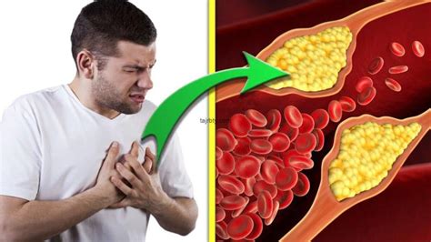 علامات ارتفاع مستويات السيروتونين في الجسم