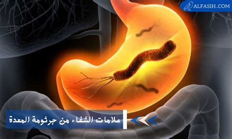 علامات التحذير من جراثيم المعدة