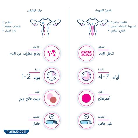 علامات انغراس البويضة في جدار الرحم بعد انفجار الإبرة