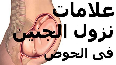 علامات تدل على أن الجنين سينزل إلى الحوض في حالة الولادة