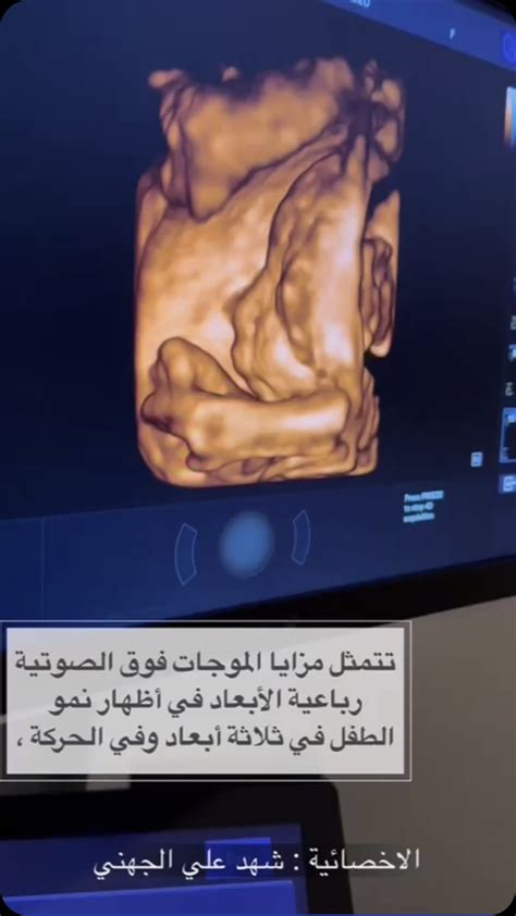 على الرغم من احتوائه على مغذيات ومغذيات قيمة، إلا أنه في بعض الحالات يمكن عكس آثاره: