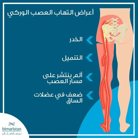 عوامل الخطر التي تمثل التهابات الأعصاب، بما في ذلك العصب الوركي