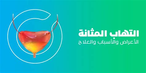 عوامل الخطر لالتهاب المثانة واعتماده على أمراض أخرى عوامل الخطر لالتهاب المثانة واعتماده على أمراض أخرى