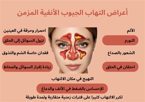 عوامل الخطر للإصابة بالتهاب الجيوب الأنفية
