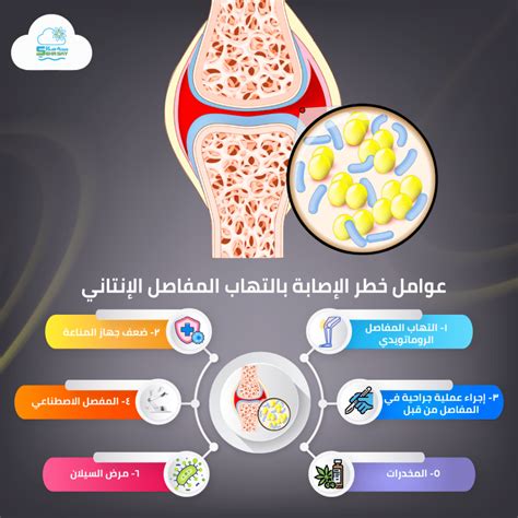 عوامل خطر الإصابة بالتهاب المفاصل الروماتويدي عوامل خطر الإصابة بالتهاب المفاصل الروماتويدي