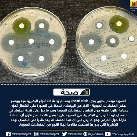 عينات مختلفة من المضاد الحيوي وتأثيراته على نمو البكتيريا؟