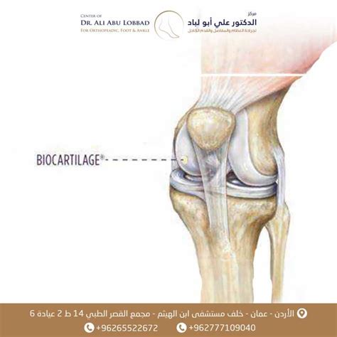 في حالة السقوط الأمامي، يجب تقويم مفاصل الركبة