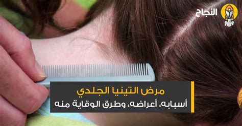 فيما يلي سنتعرف على أهم هذه الأسباب بالتفصيل: