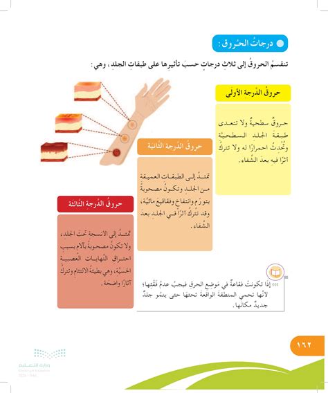 قم بإزالة الخواتم والساعة والحزام والأحذية قدر الإمكان من المنطقة المتضررة