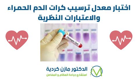 كيف تعرف أن معدل ترسيب كرات الدم الحمراء مرتفع في الجسم