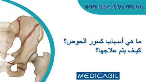 كيف يتم دعم أكتاف الحوض عندما تكون مستعدة للزراعة؟
