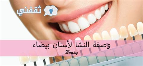 كيف يمكنني تبييض أسناني إذا كان لدي سيارة لتقويم الأسنان؟