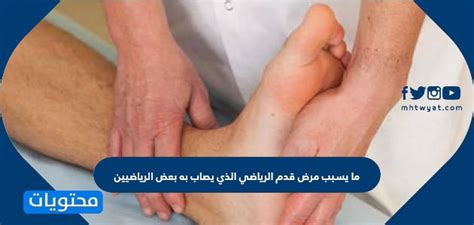 ما الذي يسبب إصابة بعض الرياضيين بقدم الرياضي؟