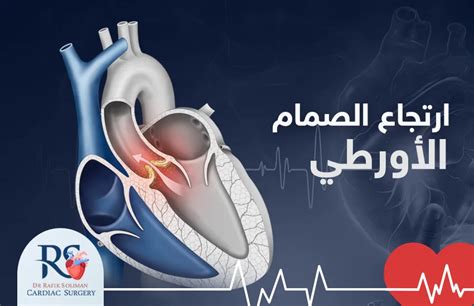 ما الذي يسبب ارتجاع الصمام التاجي؟