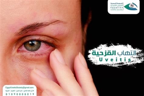 ما الذي يسبب الألم عند تحريك العين؟