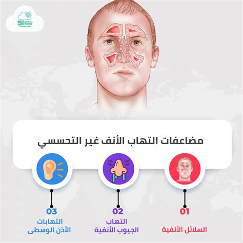 ما الذي يسبب التهاب الأنف التحسسي المزعج؟