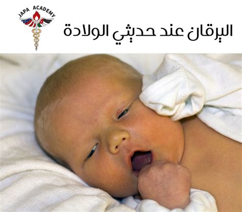 ما الذي يسبب اليرقان عند الأطفال حديثي الولادة