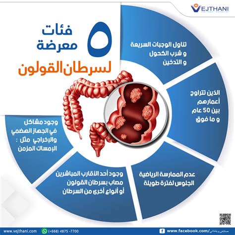 ما الذي يمكن فعله لتجنب الإصابة بسرطان القولون؟
