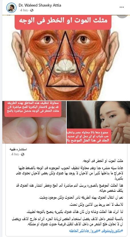 ما مدى ارتفاع مخاطر الاصابة في مثلث الموت في الوجه