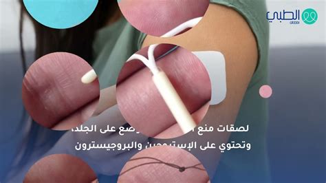 ما هي اسعار اللولب النحاسي لوسائل منع الحمل والواقي الذكري في محطة صحية بجمهورية مصر العربية لعام 2020 م؟