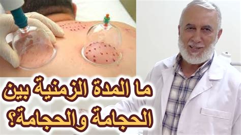 ما هي الفترة الزمنية المناسبة بين الحجامة والحجامة التالية