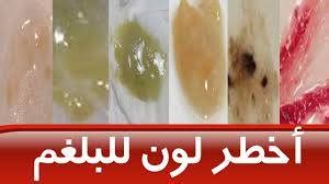 ماذا تشير ألوان البلغم؟
