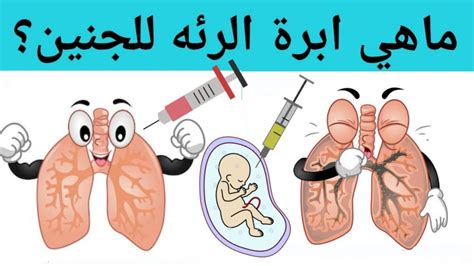 متى تبرز الحاجة إلى إعطاء المرأة الحامل جرعة حقنة من الرئة للجنين؟