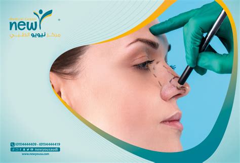 مدة استخدام ضمادة الأنف بعد الجراحة التجميلية
