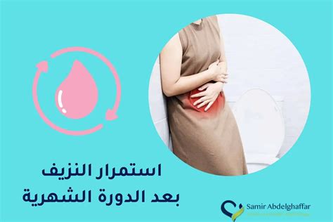 مدة استمرار النزيف والبقع المصاحبة لعملية الإجهاض