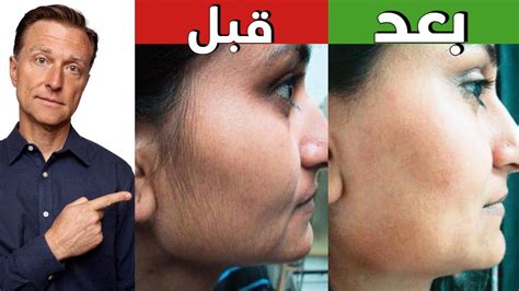 مزجها بالليمون والشوفان والبرتقال للتخلص من شعر الوجه الحساس
