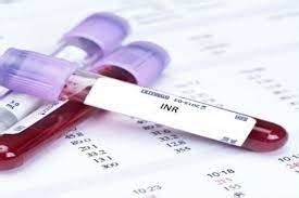 معلومات غير معروفة لك حول مضاعفات تحليل Inr
