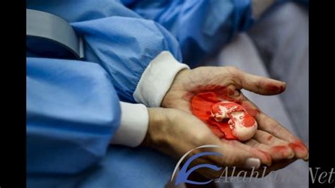 معنى رؤية الإجهاض للمرأة غير الحامل في المنام وتفسيره