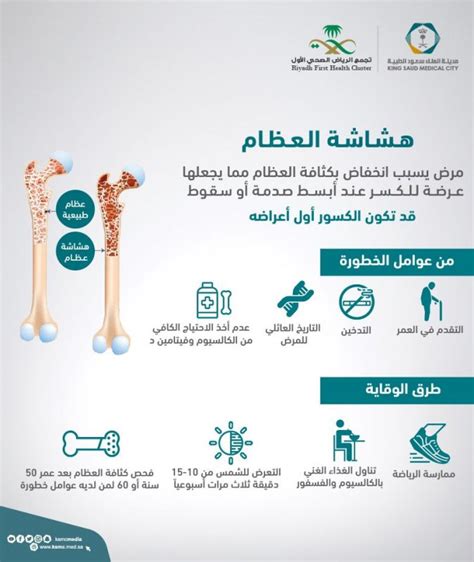مقدمة في الإذاعة المدرسية للوقاية من هشاشة العظام