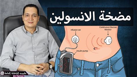 مكان وضع مضخة الأنسولين وكيفية استخدامها