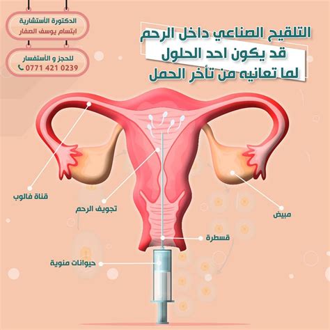 من الذي قام بالتلقيح داخل الرحم وحمل