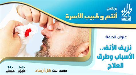 نزيف الأنف الذي يتطلب زيارة أخصائي