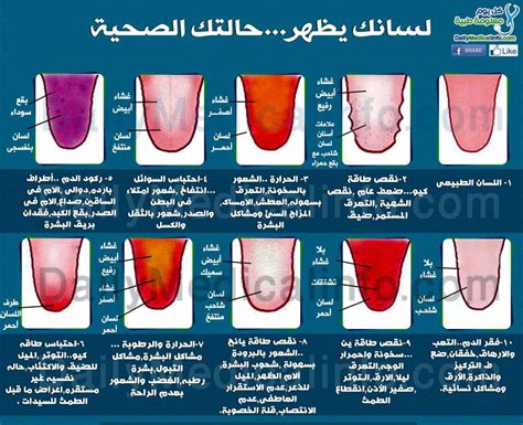 نسبة الأصفر الذي يحتاج إلى مناعة