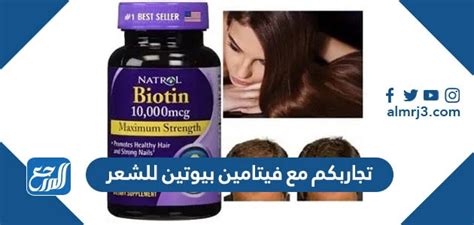 نصائح يجب اتباعها مع استخدام حبوب فيتامين للشعر