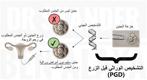 نظريات الأطباء تسبب أخطاء في تحديد جنس الجنين
