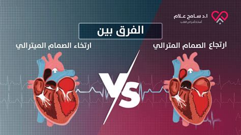 هل ارتخاء الصمام التاجي يؤدي إلى الموت؟  ما أهم المعلومات عن هذا الصمام؟
