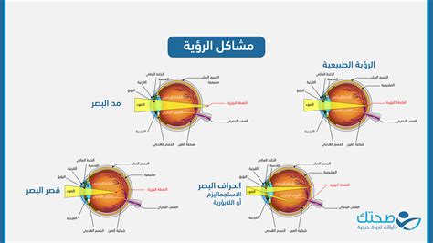 هل تصف عملية الرؤية من الضوء الذي يدخل عينيك إلى الأشعة العصبية الخارجة من الدماغ؟