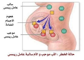 هل من الضروري أخذ الحقن عند الولادة إذا كانت نتيجة التحليل سلبية عامل رئيسي؟