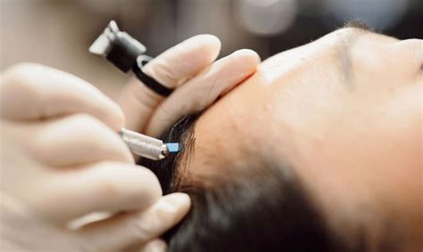 هناك بعض الحالات التي يحظر فيها اللجوء إلى استخدام تقنية microblading، ومن أهمها ما يلي: